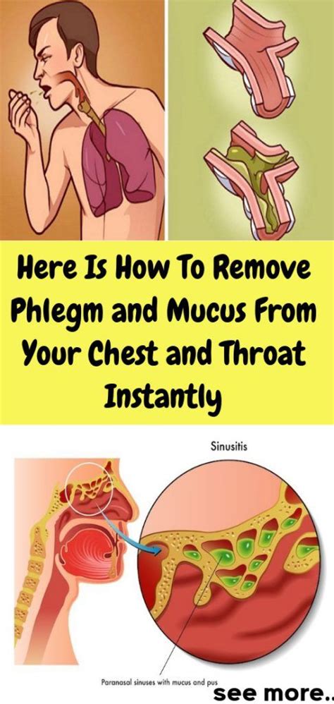 Here Is How To Remove Phlegm And Mucus From Your Chest And Throat Instantly Mucus Mucus In