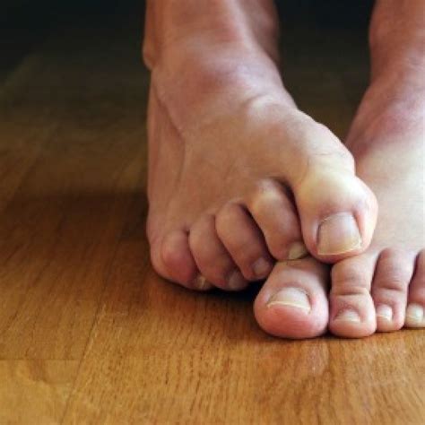 Remedies for Stinky Feet | ThriftyFun