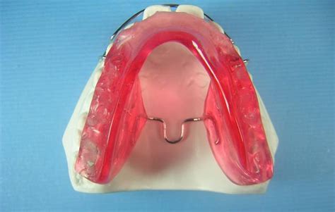 Bionator Ii To Close Accutech Orthodontic Laboratory Products