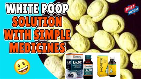 White Droppingpoop Problem Of Birds White Poop Treatment And