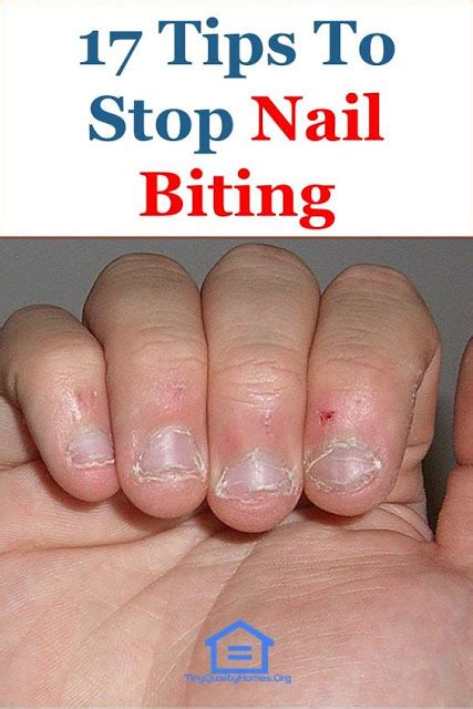 How To Stop Nail Biting Kesehatan
