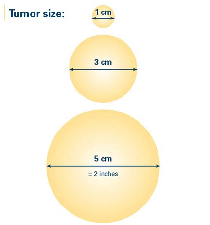 How many centimeters is 8 inches? Size of the Breast Cancer | Breastcancer.org