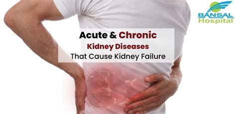 Kidney Diseases That Cause Kidney Failure Bansal Hospital