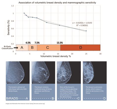 The Masking Effect Of High Mammographic Breast Density Mbd Wellend