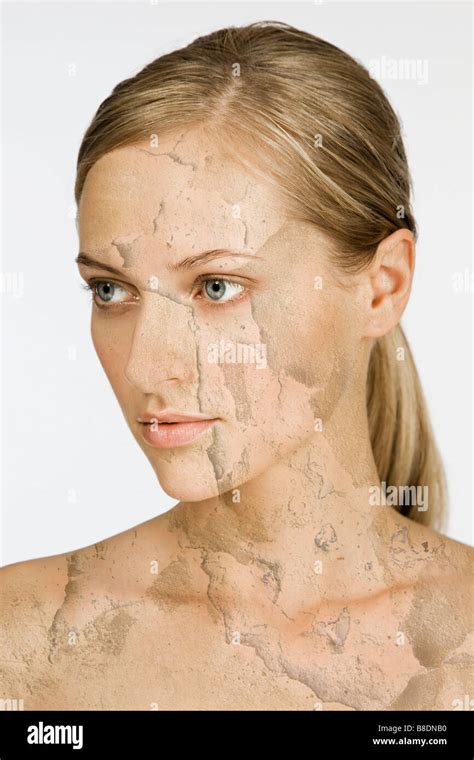 Peeling Skin Hi Res Stock Photography And Images Alamy