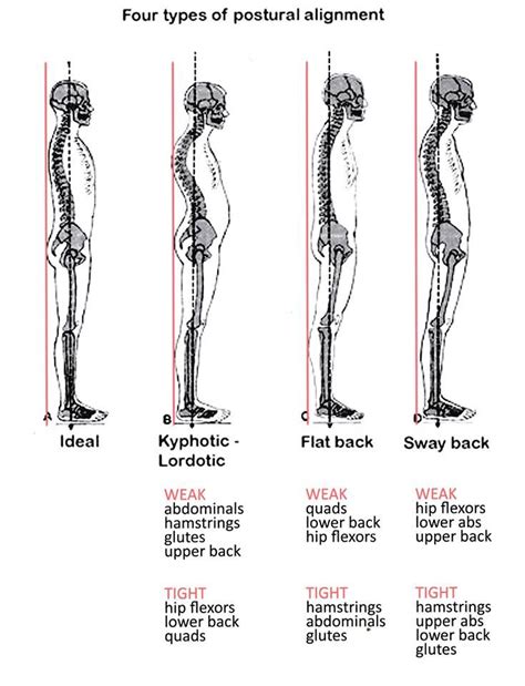How Is Your Postural Alignment