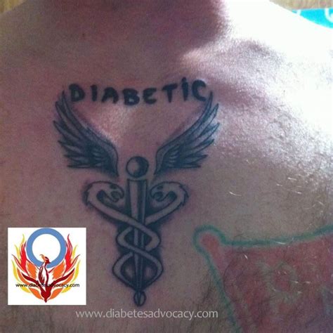 You can read more about our cookies before you choose. What You Need to Know If You Have Diabetes and Want to Get a Tattoo - Diabetes Advocacy