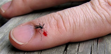 Are Itchier Insect Bites More Likely To Make Us Sick