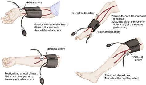 How to measure correct bp cuff size in pediatric. Principles and Procedures for Nursing Care of Children ...