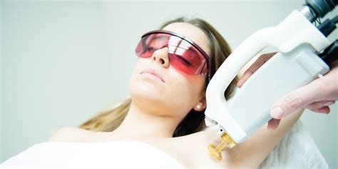 The Pros And Cons Of Laser Hair Removal Self