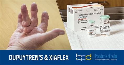 Treating Dupuytrens Contractures With Xiaflex Brandon P Donnelly Md
