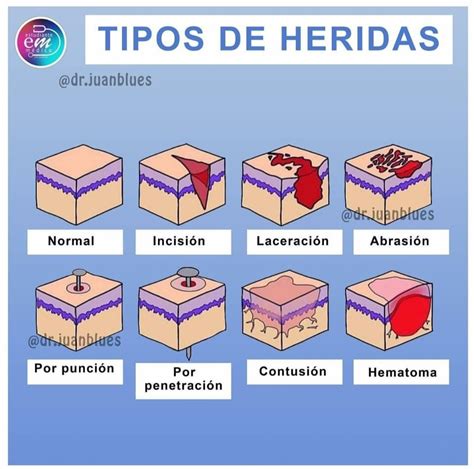 Tipos De Heridas Medicina De Urgencias Tipos De Heridas Practicas