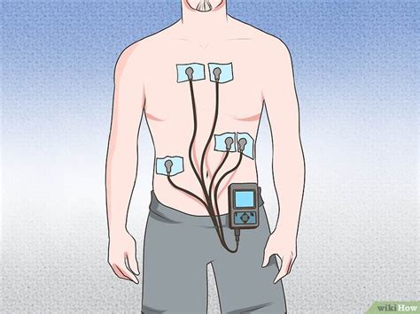 3 Formas De Usar Um Monitor Holter Wikihow