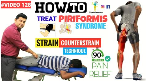 Strain Counterstrain Technique To Treat Piriformis Syndrome Pain