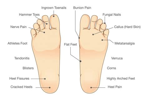 Podiatry Clinic Local Chiropodist Private Foot Clinic Podiatry