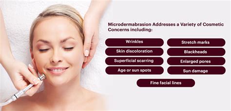 What Is Microdermabrasion
