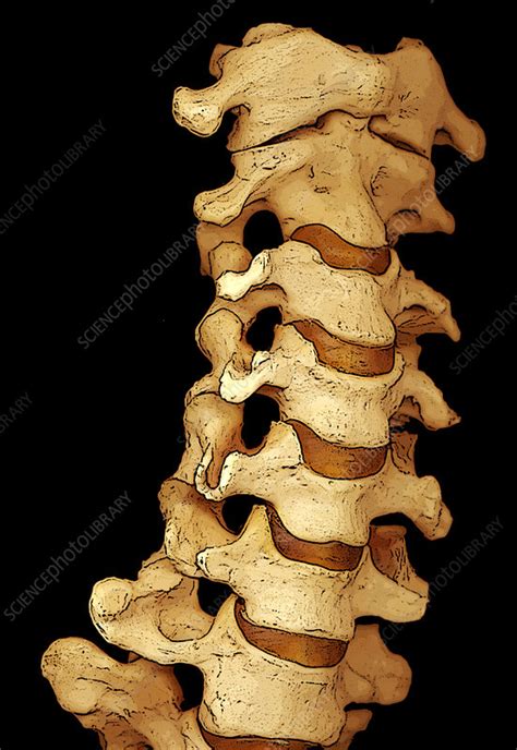 Neck Bones 3d Ct Scan Stock Image P1160648 Science Photo Library