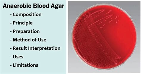 Anaerobic Blood Agar Composition Principle Preparation Results Uses