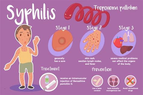 Syphilis Causes Treatment And More Solution Pharmacy