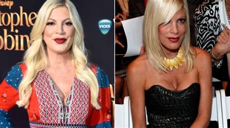 Worst Celebrity Plastic Surgery Blunders