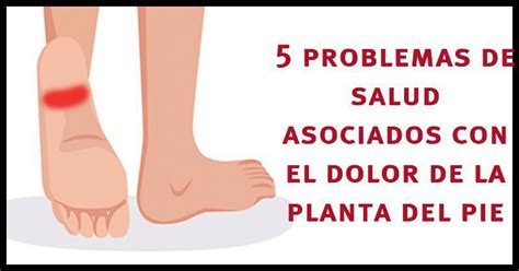 Las 5 Principales Causas De Dolor En La Planta Del Pie Images And