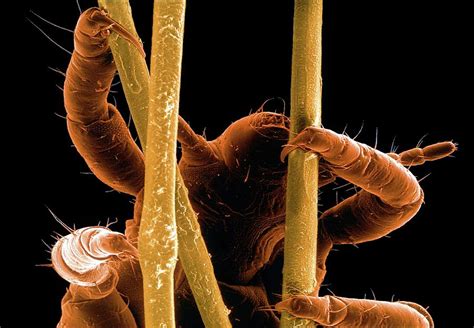 Head Louse Photograph By Thierry Berrod Mona Lisa Production Science