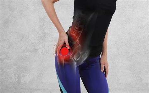 What Is Greater Trochanter Pain Syndrome And How Is It Treated