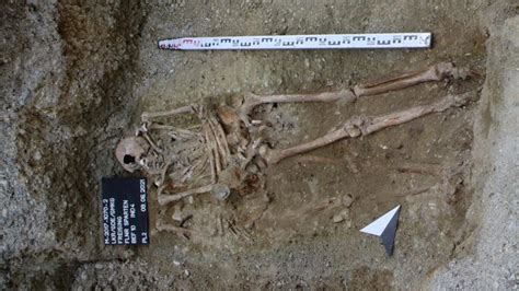 Medieval Marvel Archaeologists Unearth Skeleton With Iron Prosthetic