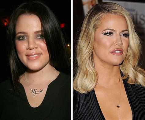 Shocking Plastic Surgery Transformations Womans Day