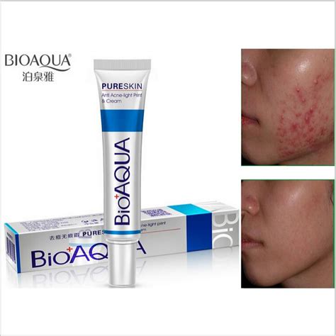 Best reviews guide analyzes and compares all whitening creams of 2021. 100% BIOAQUA Brand Acne Cream Anti Acne Removal Gel ...