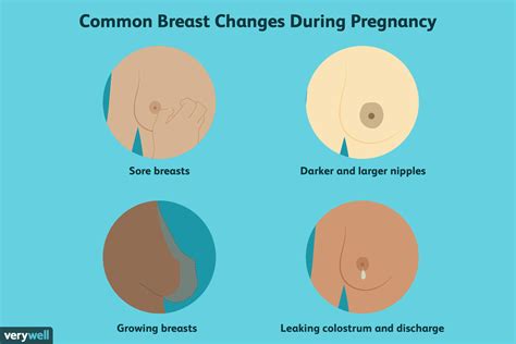 Breast Changes During Pregnancy