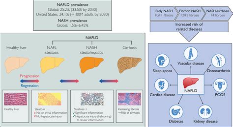 Nonalcoholic Fatty Liver Disease Review Of Management For Primary Care