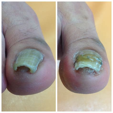 必見画像!こんなに綺麗になりました!!こんなに変化があり ...