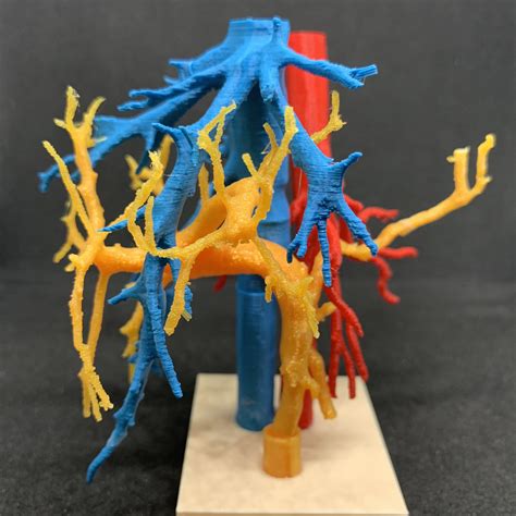 3d Printable Human Heart Model With Stackable Slices