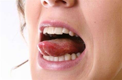 You can remedy the deficiency by eating vitamin supplement and maintaining a balanced diet. "Pimple" on My Tongue | ThriftyFun