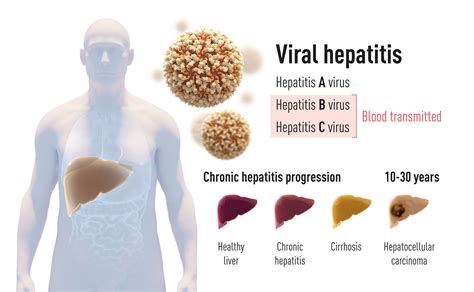 Nobel Medicine Prize Awarded To Us British Trio For Hepatitis C Discovery