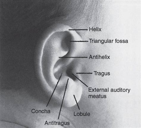 Abnormalities In Ear Shape And Position Visual Diagnosis And