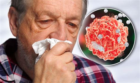 Cancer Symptoms Signs Of Tumour Include Blocked Nose Cold Virus