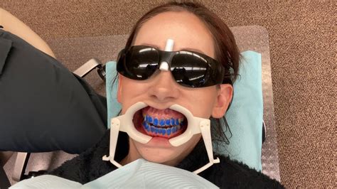 Invisalign Teeth Shaving New Attachments And Progress Youtube
