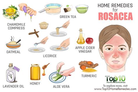 Home Remedies For Rocea Home Remedies For Rosacea Home Remedies For