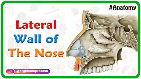 Lateral Wall Of The Nose Bones Cartilages And Mucosa Usmle