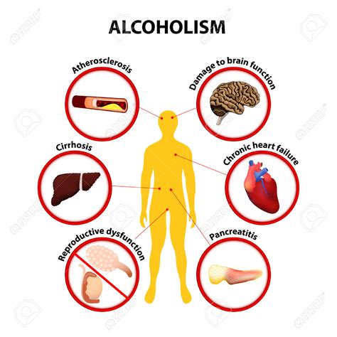 Alcohol Health Problems And Symptoms Of Use Abuse
