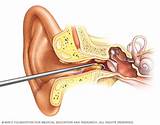 Ear Wax Doctor Near Me Pictures