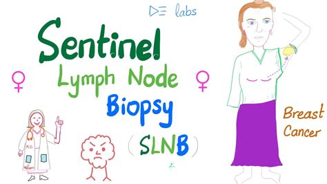 Sentinel Lymph Node Biopsy Slnb For Breast Cancer Youtube