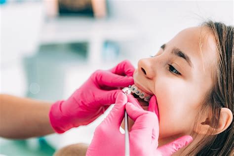 How Kids Braces Have Improved Hudson Valley Pediatric Dentistry
