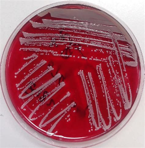 Growth Of Staphylococcus Aureus After 24 Hours On Blood Agar And