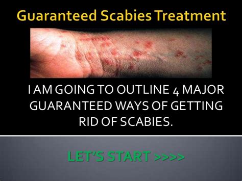 It effectively alleviates the condition by. Guaranteed Scabies Treatment