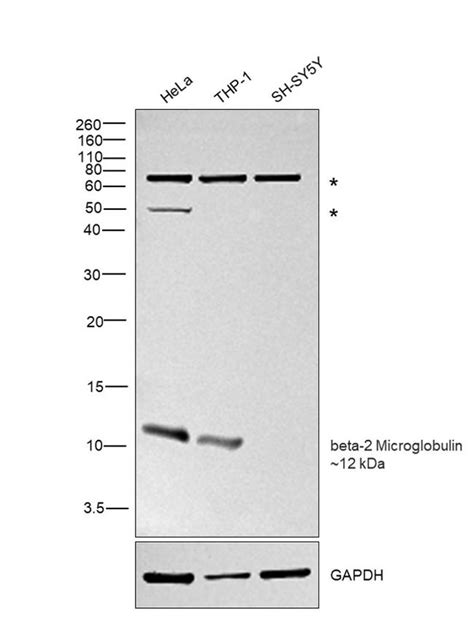 Beta 2 Microglobulin Polyclonal Antibody R0202 1e