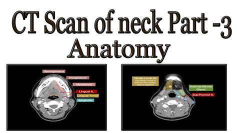 Ct Scan Of Neck Part 3 Anatomy Youtube