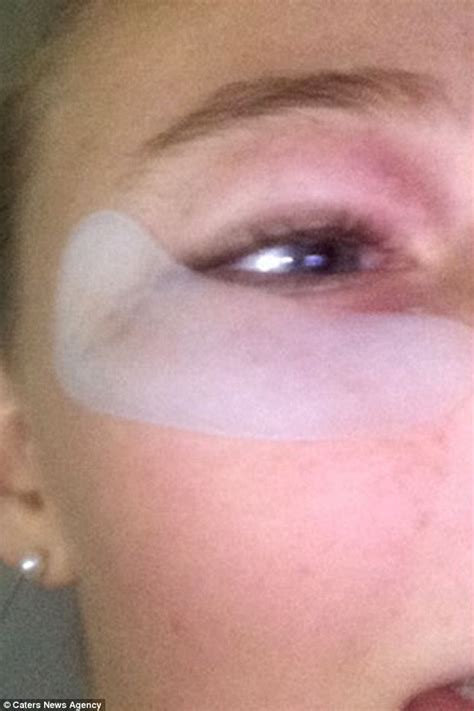 Mum Claims Daughter Was Unable To Open Eye After Using Kmart Mask Daily Mail Online